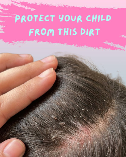 🌸 Minnies Care Anti-Lice Shampoo 🌸